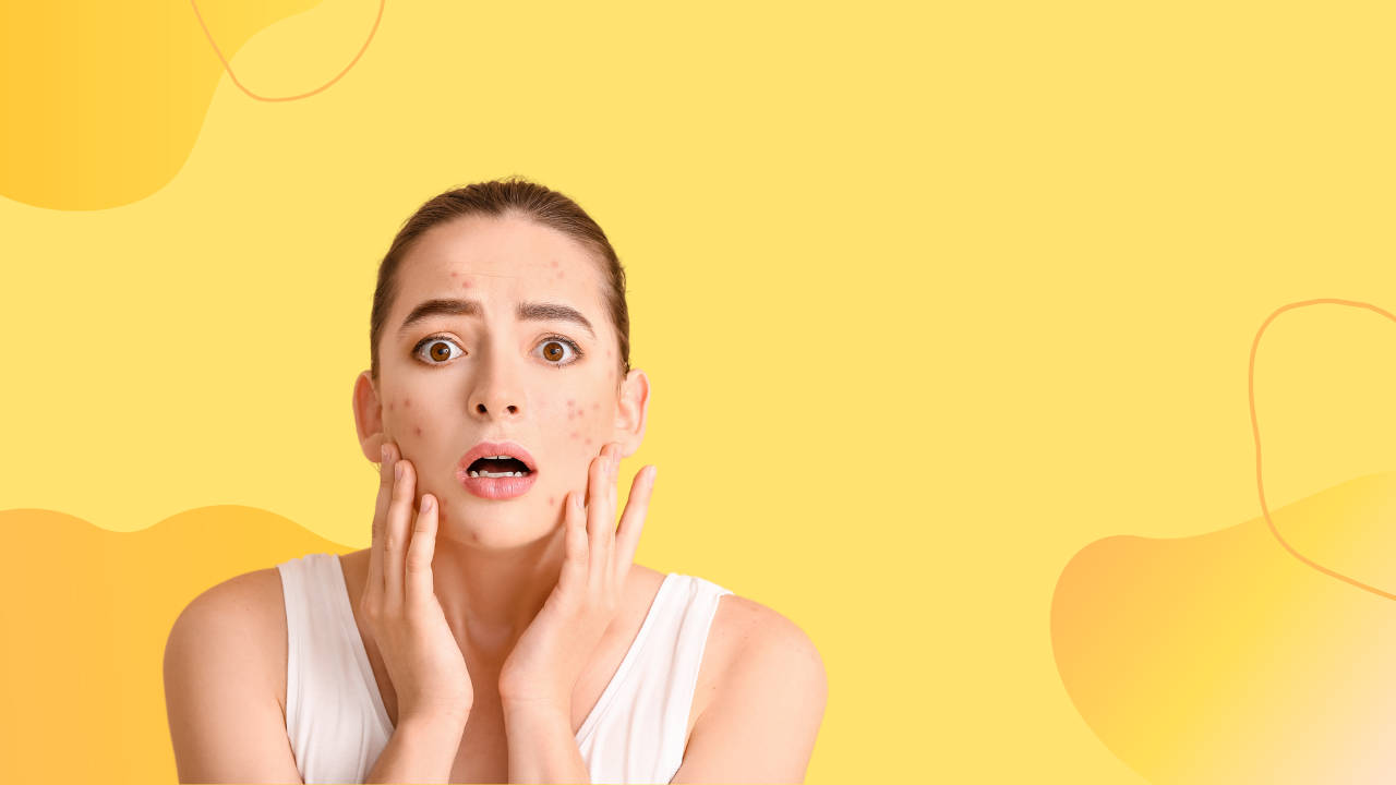 کرم ضدجوش چی بخرم؟