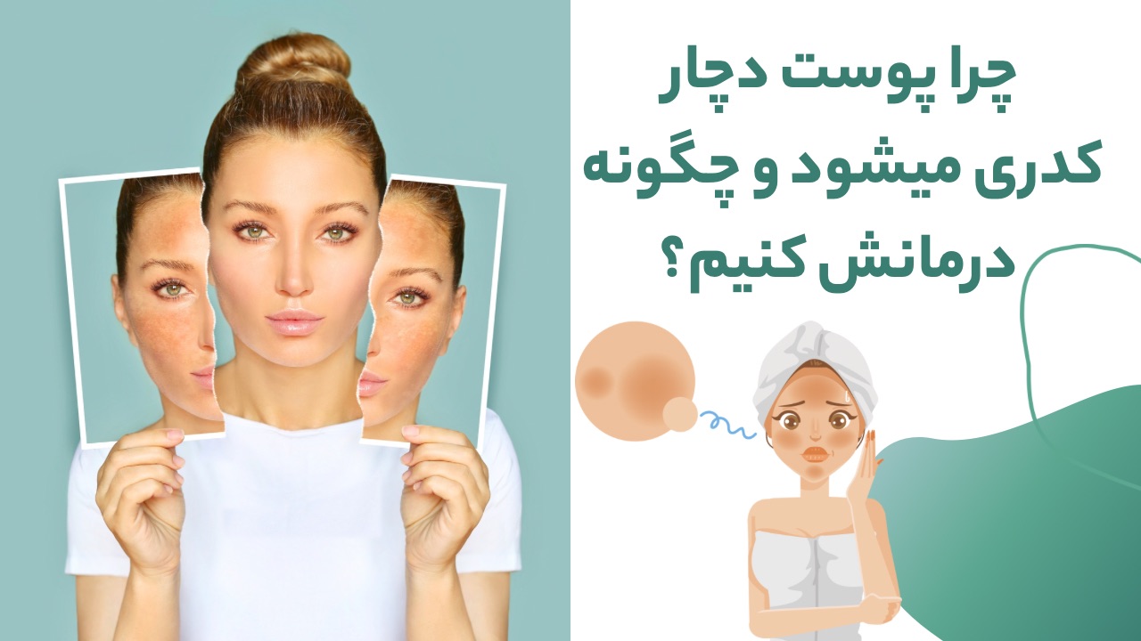 چرا پوست دچار کدری میشود؟ و چگونه درمانش کنیم؟