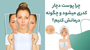 چرا پوست دچار کدری میشود؟ و چگونه درمانش کنیم؟