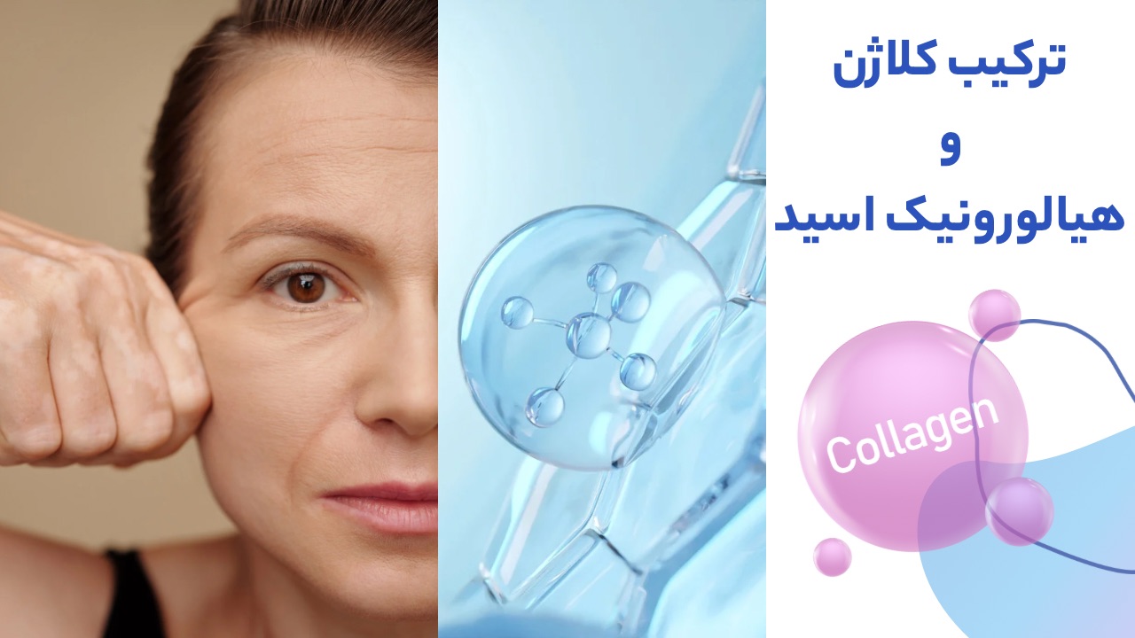 ترکیب کلاژن و هیالورونیک اسید