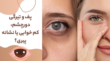 پف و تیرگی دورچشم: کم خوابی یا نشانه پیری؟ راهکار سه مرحله ای با محصولات تراست 