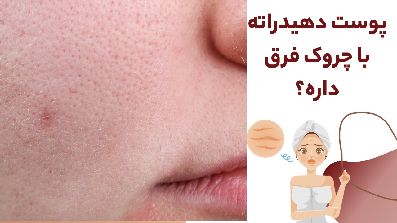 فرق پوست دهیدراته با پوست چروک