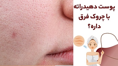 پوست دهیدراته با چروک فرق داره؟ چرا آبرسانی اولین قدم موثر برای لیفت صورت هست؟