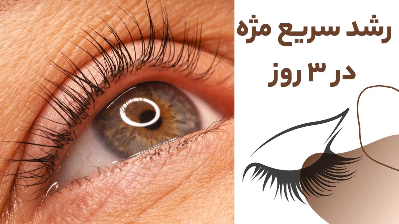 سرم تقویت مژه تراست فاقد ماینوکسیدیل