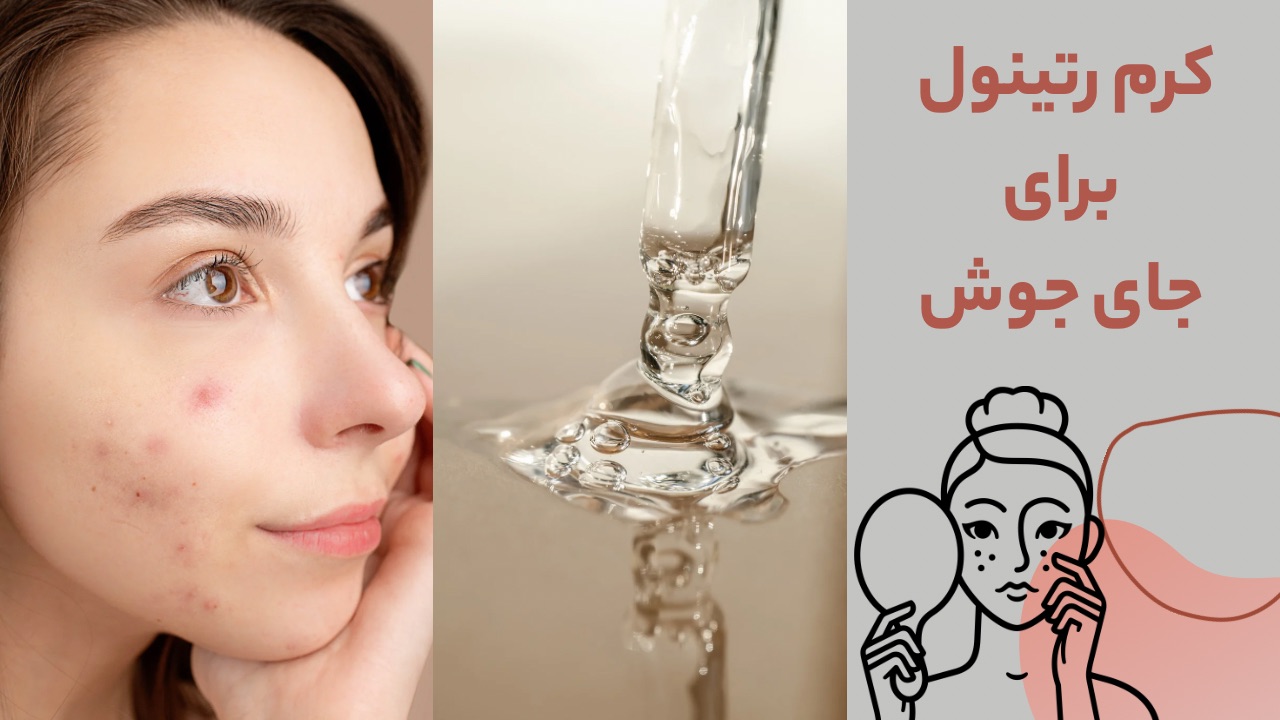 کرم رتینول برای جای جوش