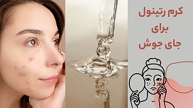 کرم رتینول برای جای جوش؛ راهکاری موثر برای پوست صاف و بدون لک