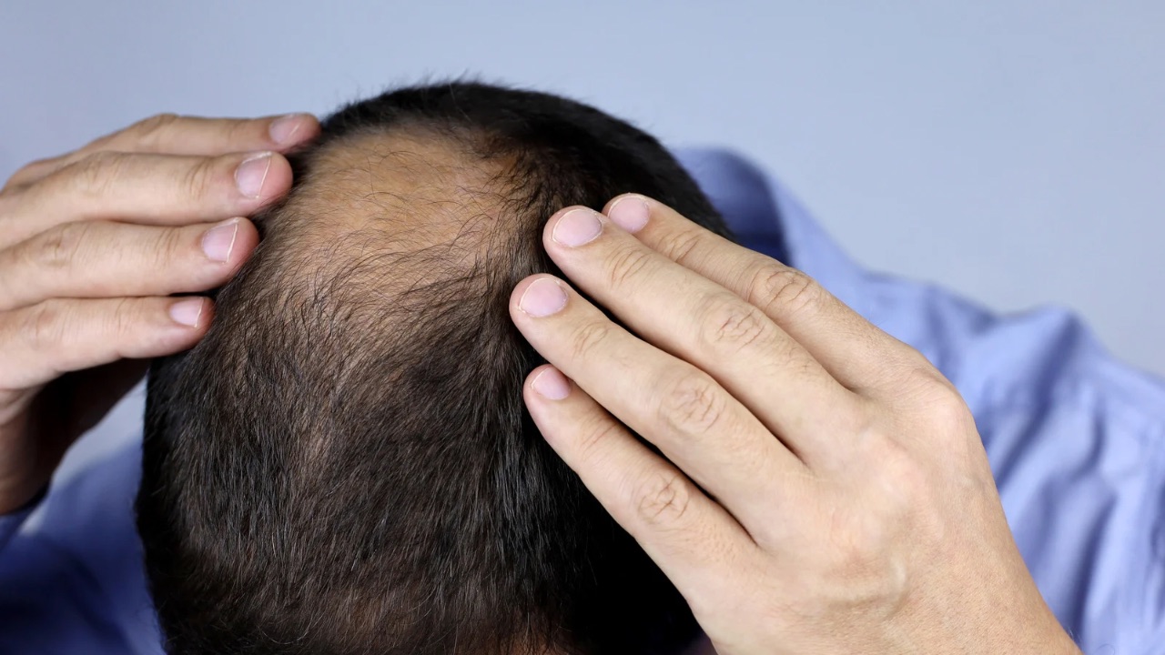 بهترین شامپو ضدریزش مو آقایان ایرانی