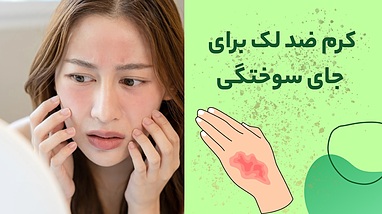 کرم ضد لک جای سوختگی؛ انتخاب مناسب برای درمان لک‌های ناشی از سوختگی