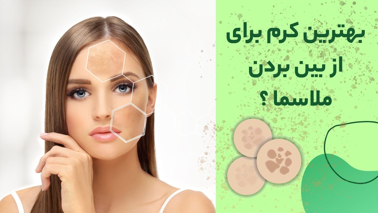 بهترین کرم ضدلک ملاسما
