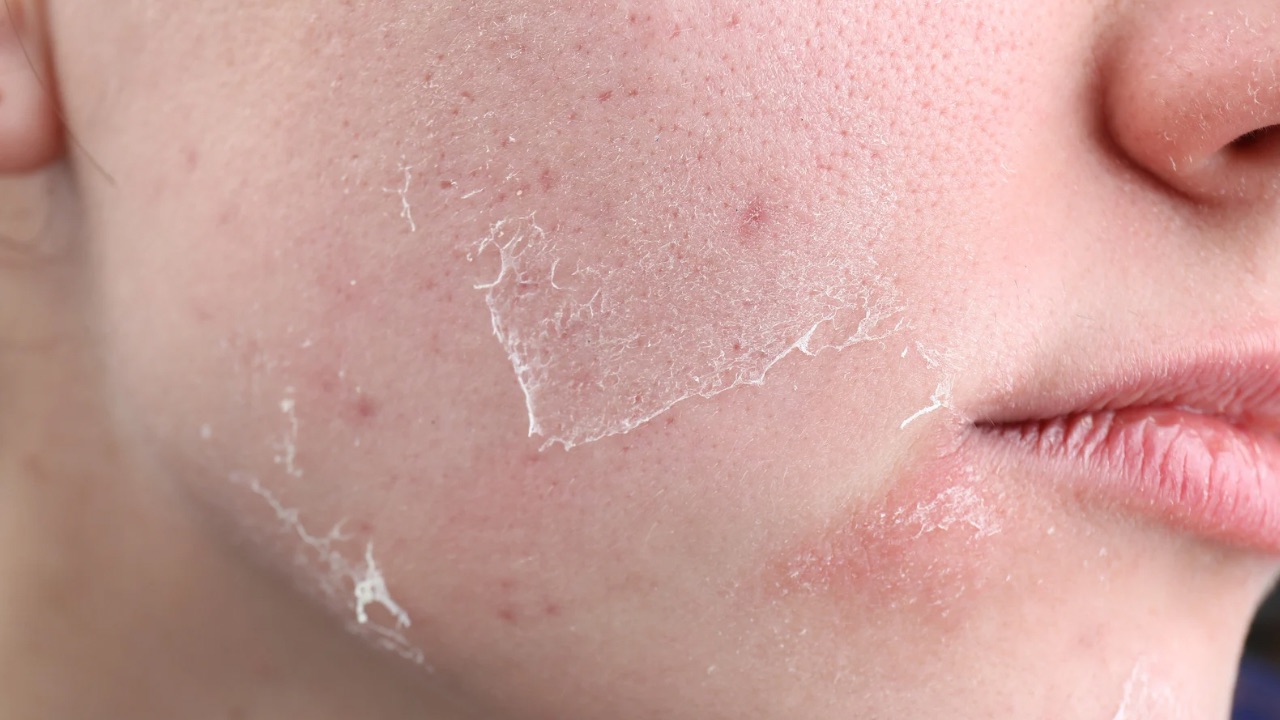 قیمت کرم آبرسان تراست پوست خشک